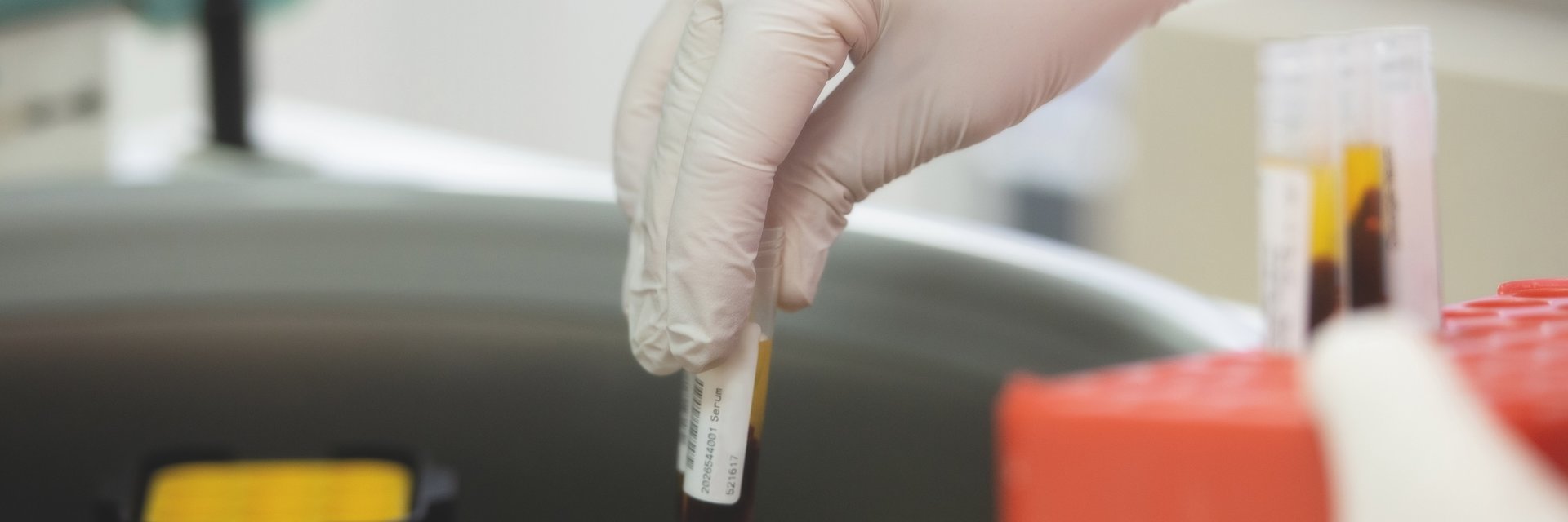 Laborfachkraft sortiert Proben ein