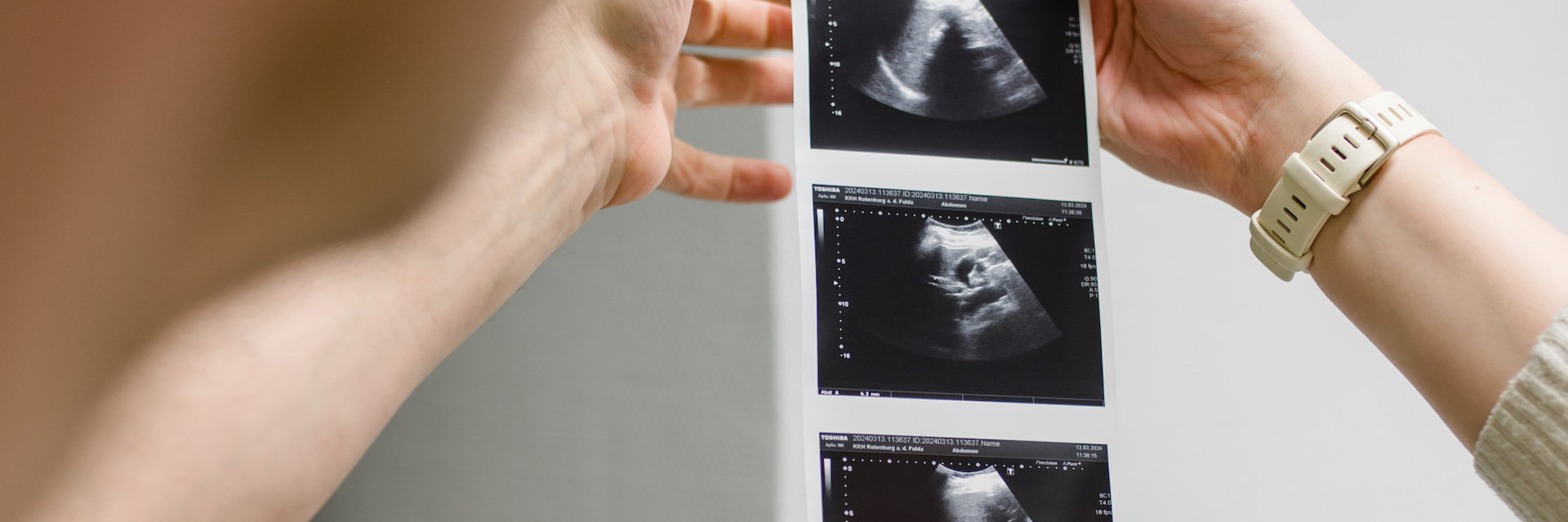 Ultraschall Ergebnisse, Bereich Onkologie